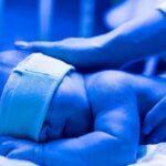 Accurate Bilirubin Measurement with Confidence: The Role of Bilirubinometers in Healthcare