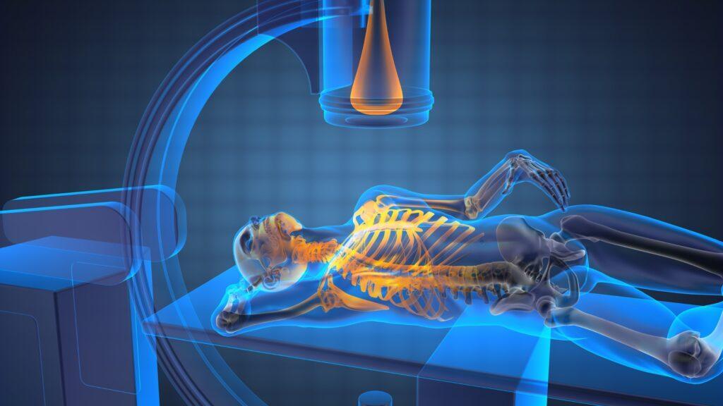 C-Arm X-Ray Machines Revolutionizing Medical Imaging for Enhanced Patient Care