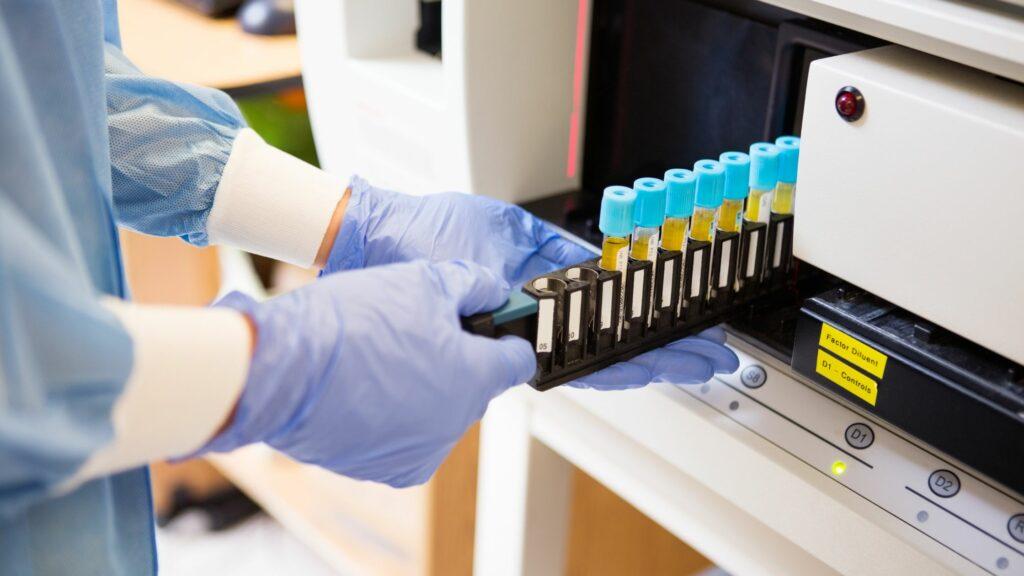 Unlocking the Potential of Coagulation Analyzers: Exploring the Various Types, Applications and Advantages They Offer