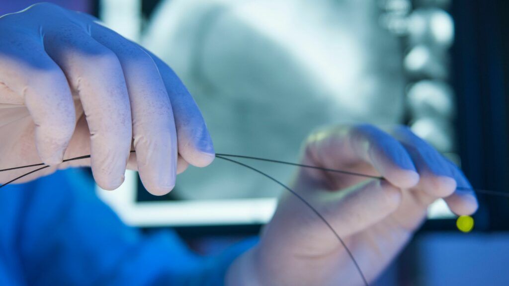 Mastering Guidewires: Navigating the Essentials of Medical Device Precision
