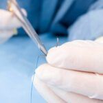 Unveiling the Benefits and Applications of Stitch Cutters: A Step-by-Step process for Optimal Usage and Maintenance
