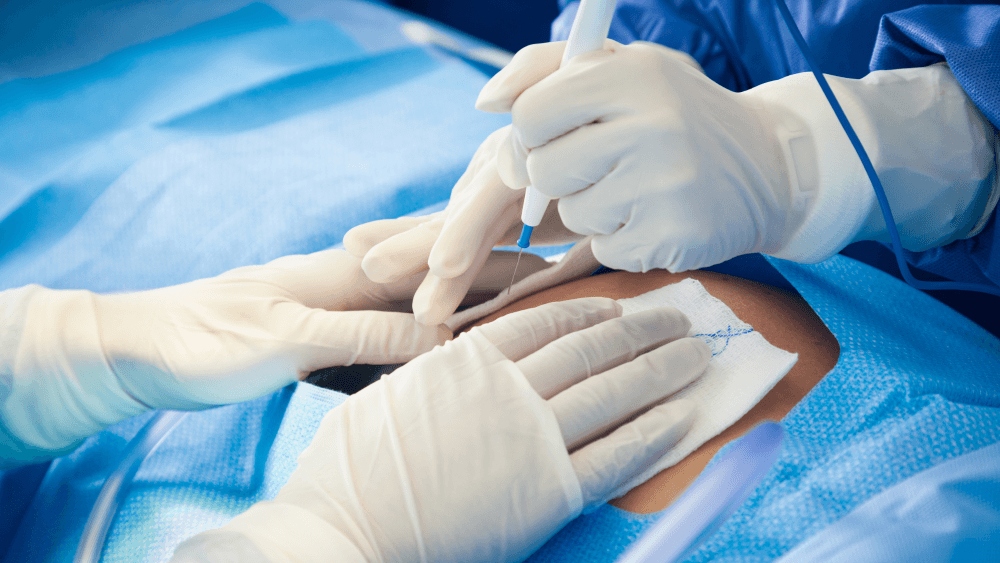 Surgical Drapes: Selecting the Right Material and Sterilization Method for Safe and Effective Surgeries