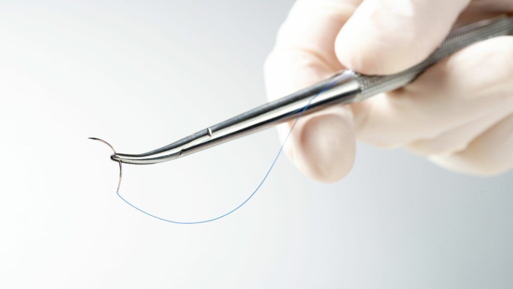 Medical Sutures: Types, Selection, Usage, and Management