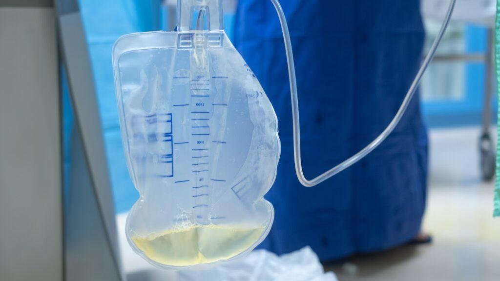 Mastering Urine Bags : Types, Uses and Best Practices