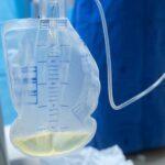 Mastering Urine Bags : Types, Uses and Best Practices