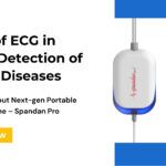 ECG role in heart disease detection - Spandan Pro ECG Machine spotlight